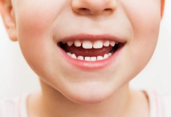 子どもの歯の矯正費用、医療費控除の対象になる？ならない？